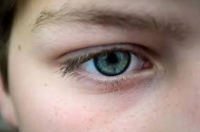 Dokter Ungkap Mata Kedutan Bisa Jadi Tanda Stres dan Perlu Diwaspadai